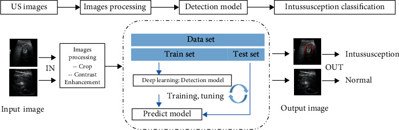 Performance of Deep Learning-Based Algorithm for Detection of Pediatric Intussusception on Abdominal Ultrasound Images.