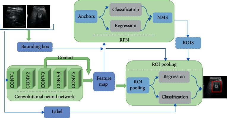 Performance of Deep Learning-Based Algorithm for Detection of Pediatric Intussusception on Abdominal Ultrasound Images.