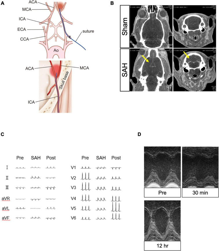 Assessment of cardiac function in rat endovascular perforation model of subarachnoid hemorrhage; A model of subarachnoid hemorrhage-induced cardiac dysfunction.