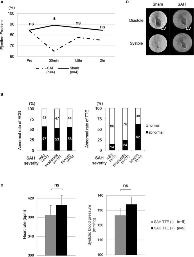 Assessment of cardiac function in rat endovascular perforation model of subarachnoid hemorrhage; A model of subarachnoid hemorrhage-induced cardiac dysfunction.