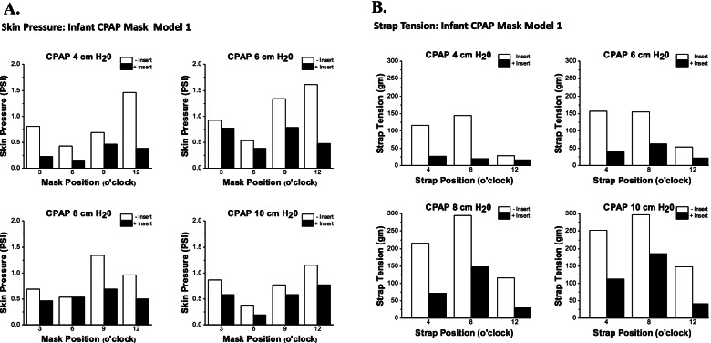 Workflow to develop 3D designed personalized neonatal CPAP masks using iPhone structured light facial scanning.