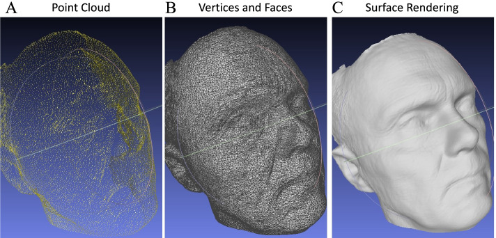 Workflow to develop 3D designed personalized neonatal CPAP masks using iPhone structured light facial scanning.