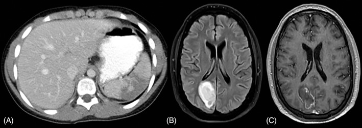 Current trends in image-guided chest interventions.