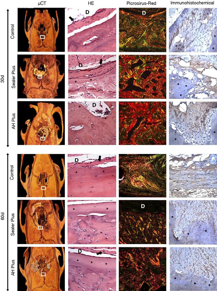 Laboratory study of tissue repair of resin-based endodontic sealers in critical surgical defects.