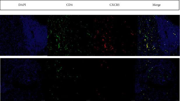 Clinical Characteristics and Potential Mechanisms in Patients with Abnormal Liver Function Indices and Elevated Serum IgG4.