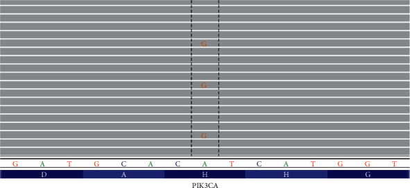 Case Report of Fibro-Adipose Vascular Anomaly (FAVA) with Activating Somatic <i>PIK3CA</i> Mutation.