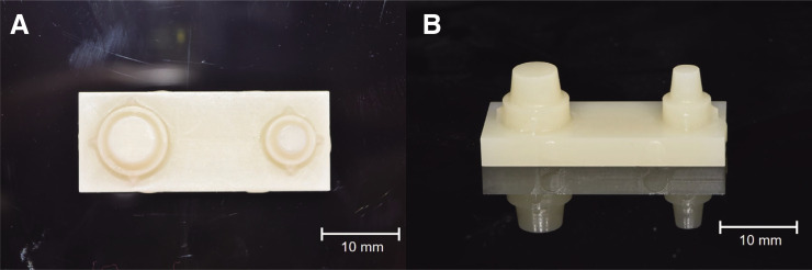 Investigation of the marginal fit of a 3D-printed three-unit resin prosthesis with different build orientations and layer thicknesses.