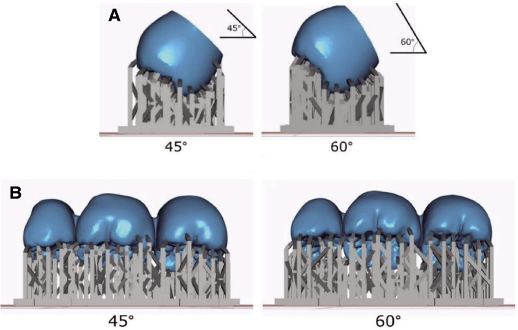 Investigation of the marginal fit of a 3D-printed three-unit resin prosthesis with different build orientations and layer thicknesses.