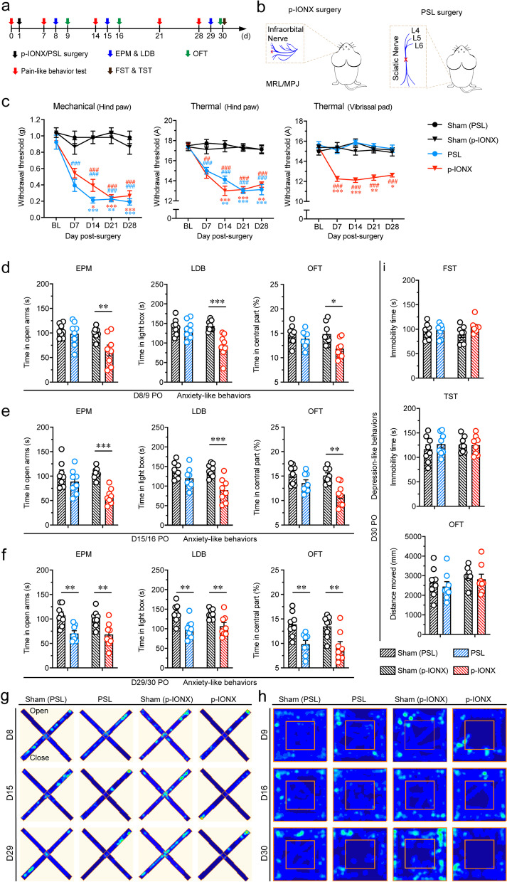 HMGB1 in the mPFC governs comorbid anxiety in neuropathic pain.
