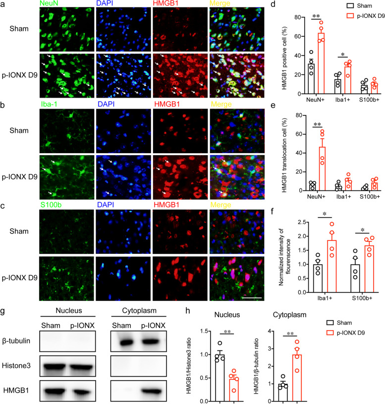 HMGB1 in the mPFC governs comorbid anxiety in neuropathic pain.