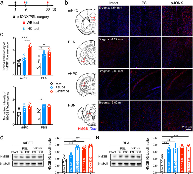 HMGB1 in the mPFC governs comorbid anxiety in neuropathic pain.