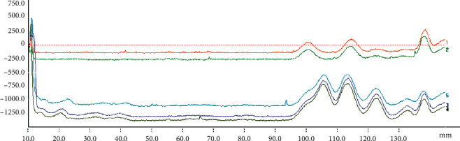 Determination of Five Coumarins in Angelicae Pubescentis Radix from Different Origins by HPTLC-Scanning.