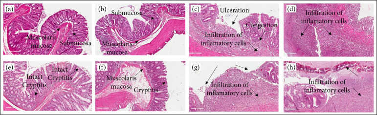 Treatment of colitis by oral negatively charged nanostructured curcumin in rats.