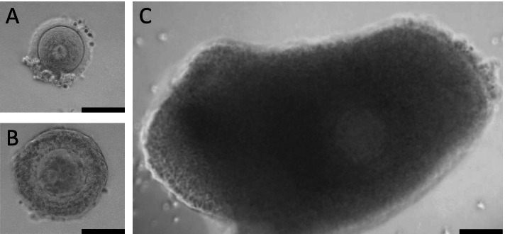 Concentrations of oocyte secreted GDF9 and BMP15 decrease with MII transition during human IVM.