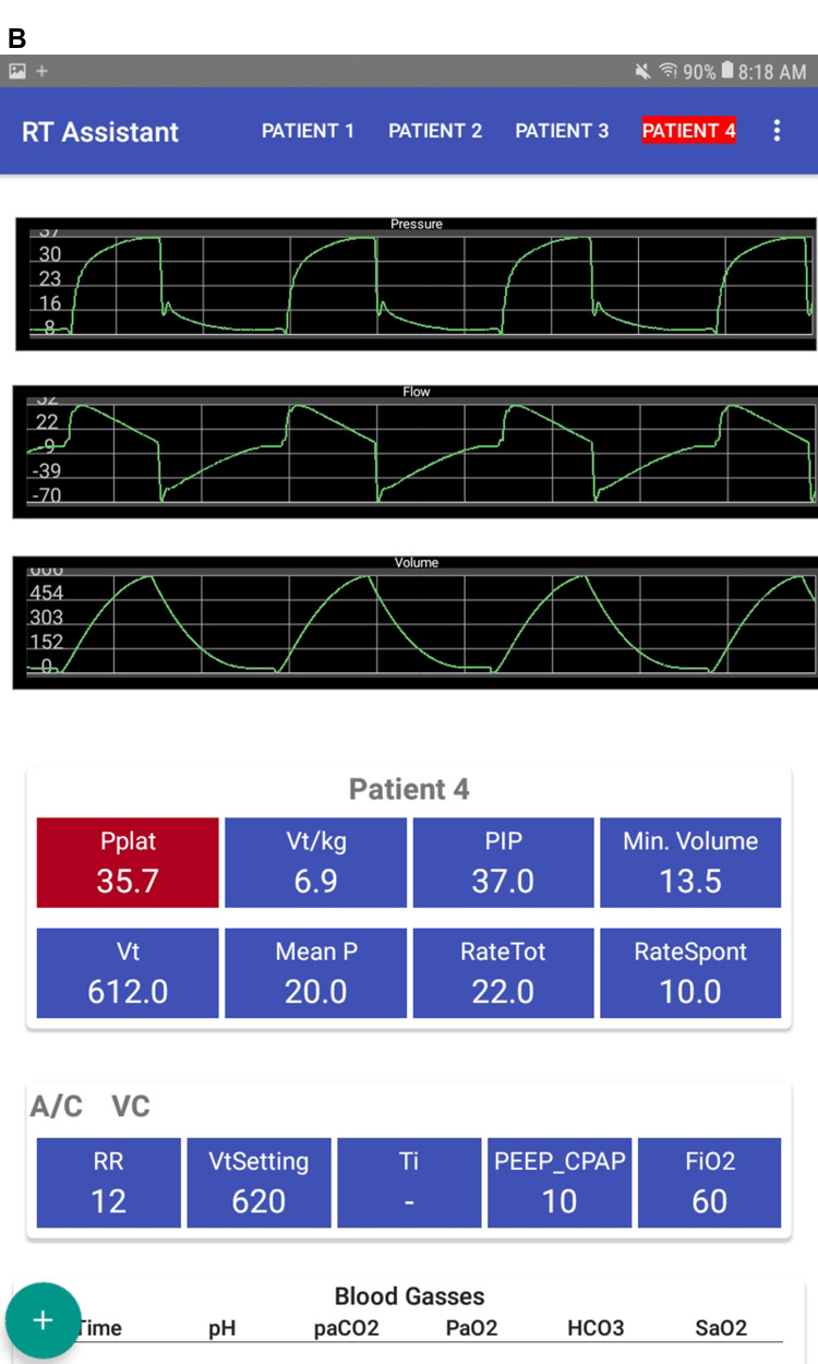 Use of a Portable Electronic Interface Improves Clinical Handoffs and Adherence to Lung Protective Ventilation.