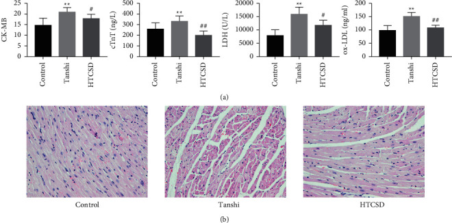 Nontargeted Metabolomic Profiling of Huo-Tan-Chu-Shi Decoction in the Treatment of Coronary Heart Disease with Phlegm-damp Syndrome.