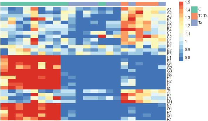 Differential RNA aptamer affinity profiling on plasma as a potential diagnostic tool for bladder cancer.