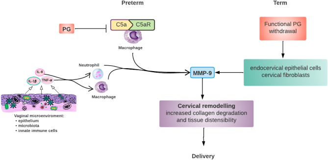 Matrix metalloproteinase-induced cervical extracellular matrix remodelling in pregnancy and cervical cancer.