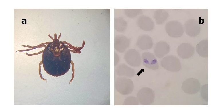 An atypical case of Babesia bigemina parasitising a dog from a rural area of eastern Mexico.