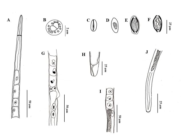 A new species of Huffmanela (Nematoda: Trichosomoididae) parasitizing Colomesus psittacus (Tetraodontiformes) from Marajó Island, Pará State, Brazil.
