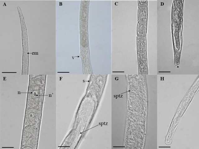 A new species of Huffmanela (Nematoda: Trichosomoididae) parasitizing Colomesus psittacus (Tetraodontiformes) from Marajó Island, Pará State, Brazil.