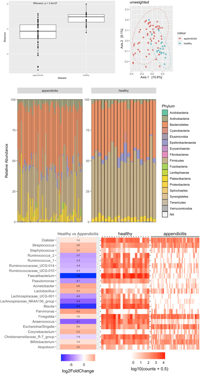 The microbiome in adult acute appendicitis.