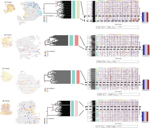 Inference on spatial heterogeneity in tumor microenvironment using spatial transcriptomics data