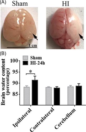 AQP4 knockout promotes neurite outgrowth via upregulating GAP43 expression in infant rats with hypoxic-ischemic brain injury