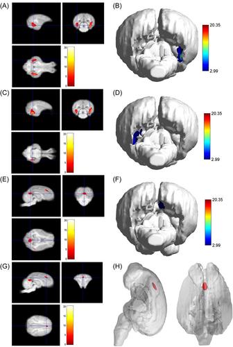 Brain structure analysis of different age groups of Diannan small-ear pigs