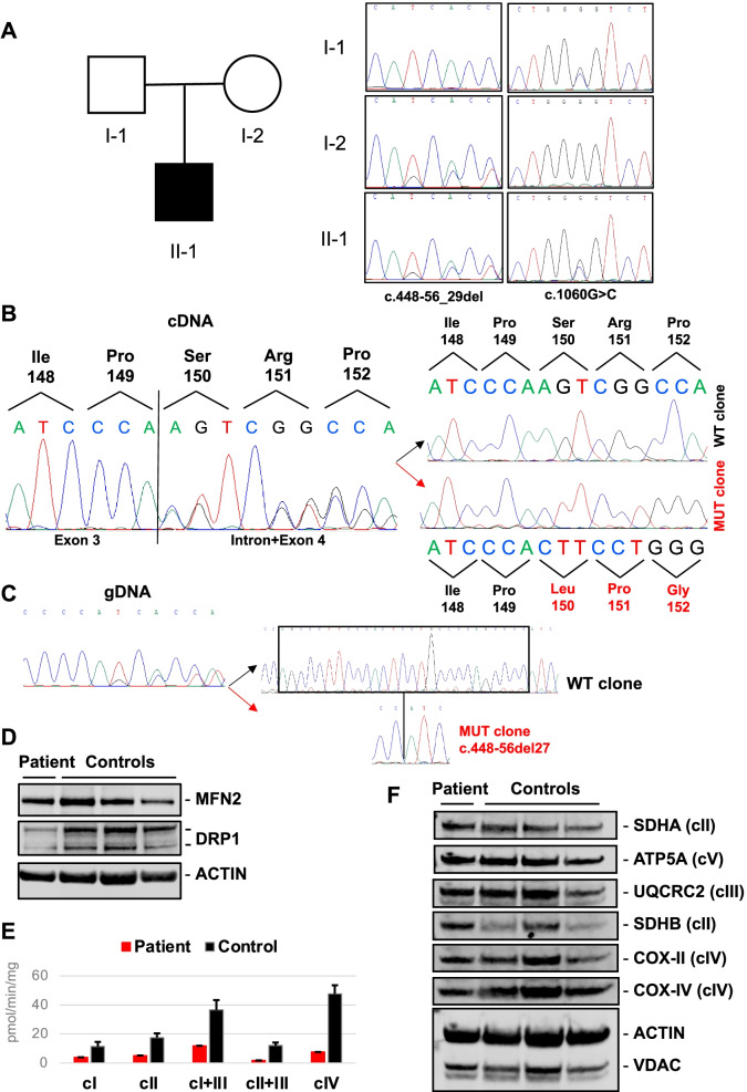 Megaconial congenital muscular dystrophy due to novel CHKB variants: a case report and literature review.