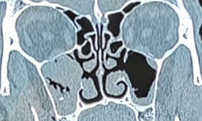 Abstract Image