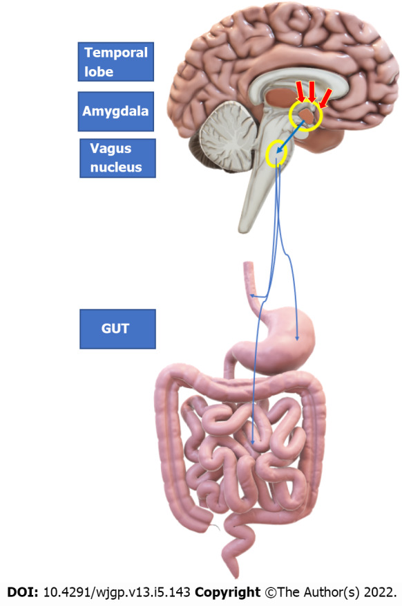 Epilepsy and the gut: Perpetrator or victim?