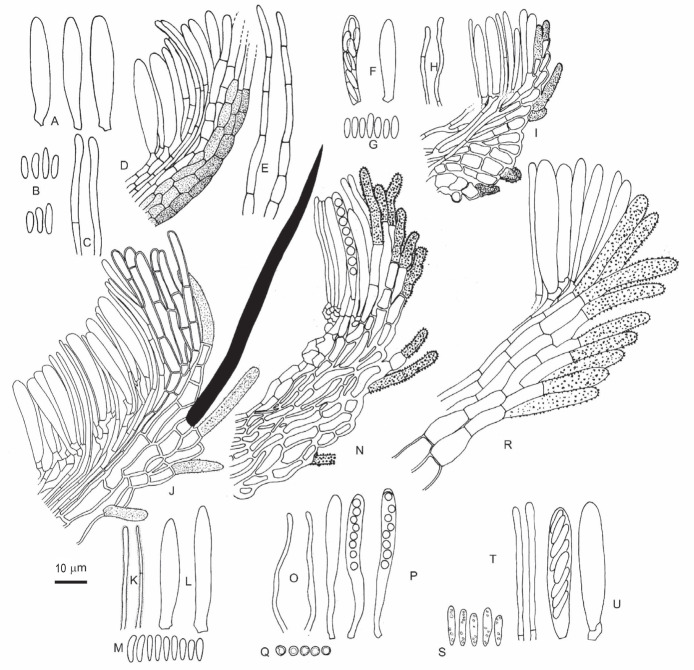 A review of <i>Hyphodiscaceae</i>.