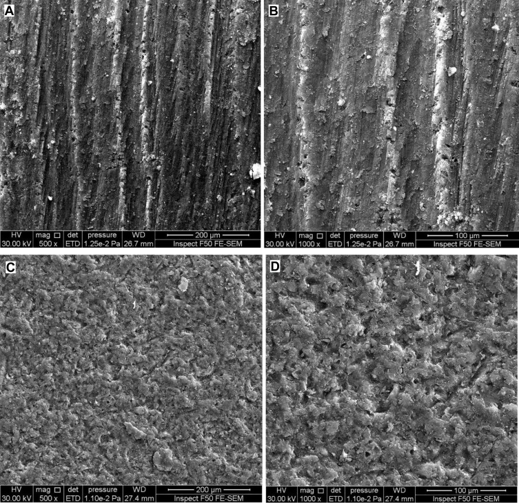 Silanizing Effectiveness on the Bond Strength of Aged Bulk-Fill Composite Repaired After Sandblasting or Bur Abrasion Treatments: An in vitro Study.