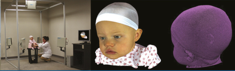 Applications of 3D Photography in Craniofacial Surgery.