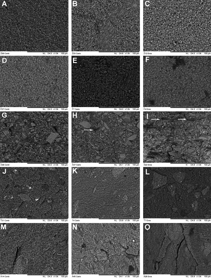 Bulk-fill restorative composites under simulated carious and erosive conditions.