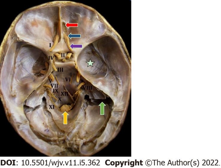 Anatomophysiological relationships and clinical considerations of taste and smell loss in patients with COVID-19.