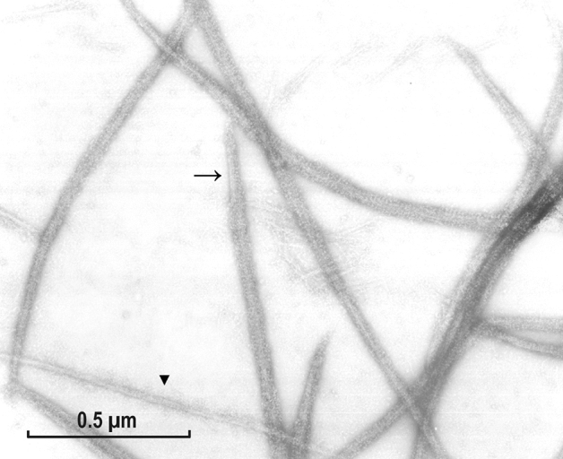 Myosin assembly of smooth muscle: from ribbons and side polarity to a row polar helical model.