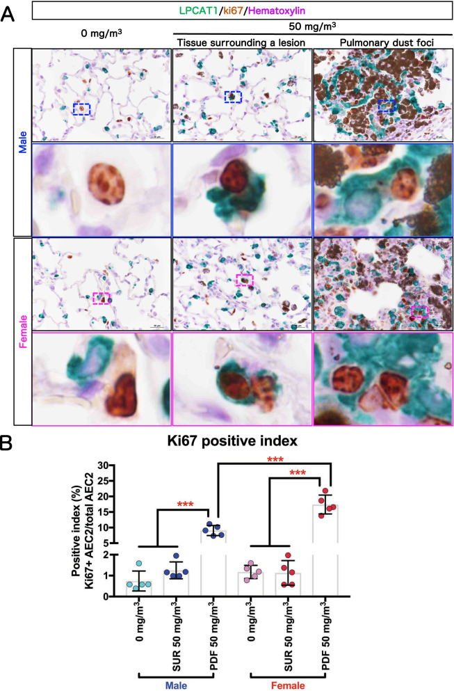 Pulmonary dust foci as rat pneumoconiosis lesion induced by titanium dioxide nanoparticles in 13-week inhalation study.