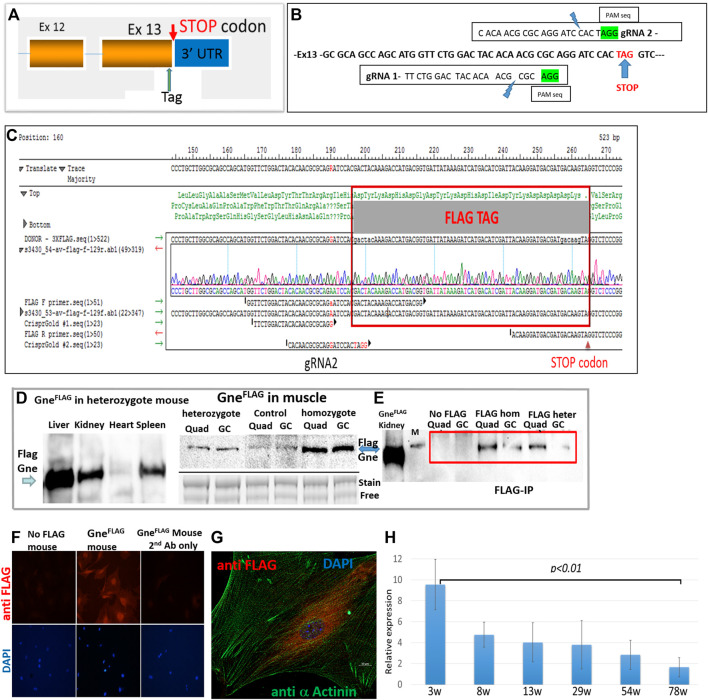 <i>In vivo</i> and <i>in vitro</i> genome editing to explore GNE functions.