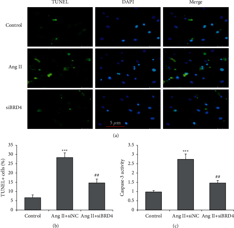 BRD4 Silencing Protects Angiotensin II-Induced Cardiac Hypertrophy by Inhibiting TLR4/NF-<i>κ</i>B and Activating Nrf2-HO-1 Pathways.