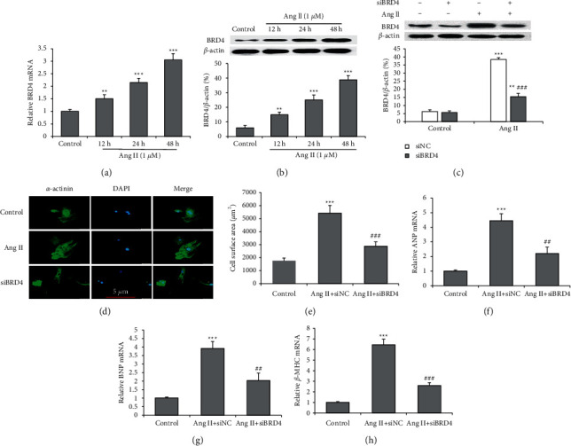 BRD4 Silencing Protects Angiotensin II-Induced Cardiac Hypertrophy by Inhibiting TLR4/NF-<i>κ</i>B and Activating Nrf2-HO-1 Pathways.