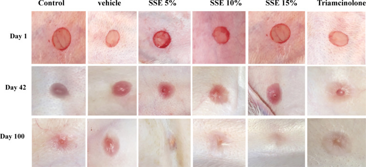 Hydroalcoholic Extract of <i>Scrophularia Striata</i> Attenuates Hypertrophic Scar, Suppresses Collagen Synthesis, and Stimulates MMP2 and 9 Gene Expression in Rabbit Ear Model.