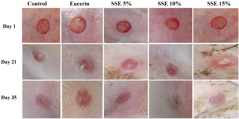 Hydroalcoholic Extract of <i>Scrophularia Striata</i> Attenuates Hypertrophic Scar, Suppresses Collagen Synthesis, and Stimulates MMP2 and 9 Gene Expression in Rabbit Ear Model.