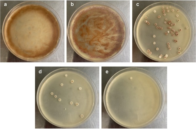 Breeding of High Daptomycin-Producing Strain by Streptomycin Resistance Superposition.