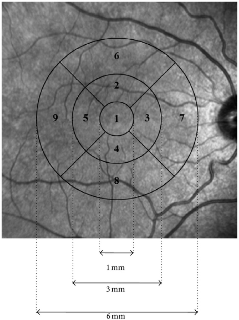 Retinal Ganglion Cell Complex in Alzheimer Disease: Comparing Ganglion Cell Complex and Central Macular Thickness in Alzheimer Disease and Healthy Subjects Using Spectral Domain-Optical Coherence Tomography.