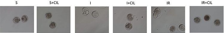 The protective effect of cilostazol on experimental ischemia/reperfusion injury in rats ovaries on in vitro fertilization outcomes.