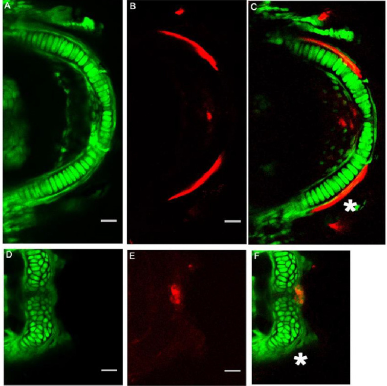 The Shape of the Jaw-Zebrafish Col11a1a Regulates Meckel's Cartilage Morphogenesis and Mineralization.