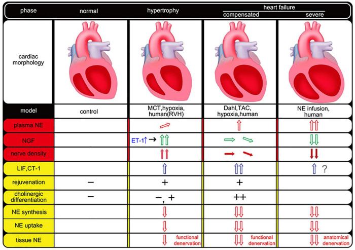 The plasticity of cardiac sympathetic nerves and its clinical implication in cardiovascular disease.