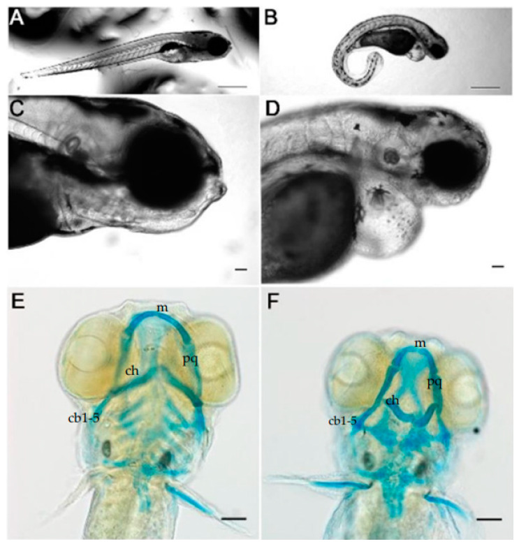 The Shape of the Jaw-Zebrafish Col11a1a Regulates Meckel's Cartilage Morphogenesis and Mineralization.